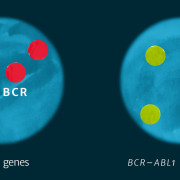 A diagrammatic representation of the FISH Test for CML